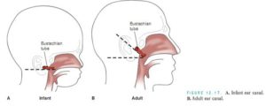 Informatio nabout ear infectinos and what causes them in children