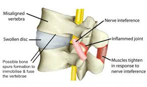 An Adjustment vs. Cracking Your Own Back  Tulsa Chiropractor - Schluter  Chiropractic