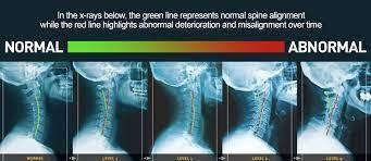 spine-and-nervous-system